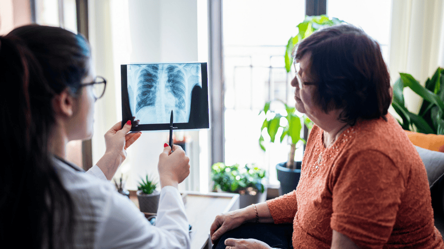 Center for Advanced Lung Disease and Transplantation image