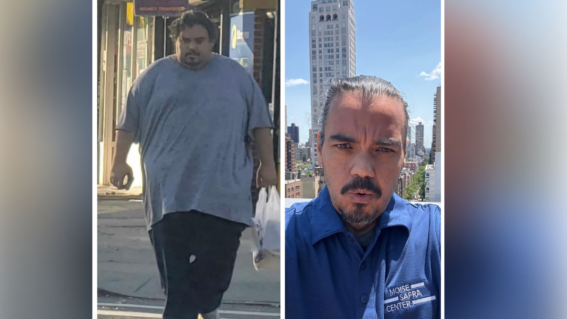side by side of David before and after surgery