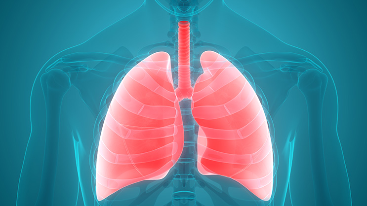 stage 4 non small cell lung cancer prognosis without treatment