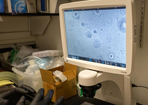 photograph of a digital screen showing organoids from the cells of patients with colon cancer.