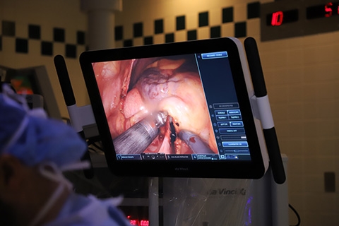Photograph showing a monitor with a real-time high-resolution view of the surgical site.