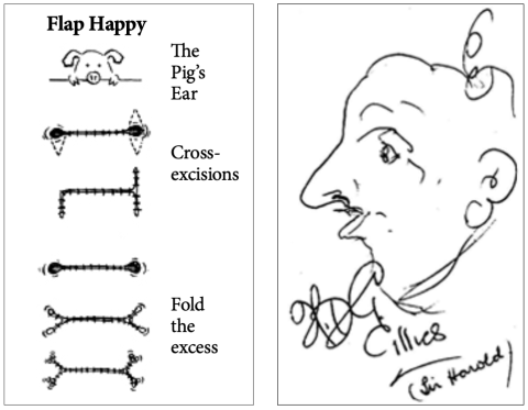 flap happy cartoon plastic surgery webster