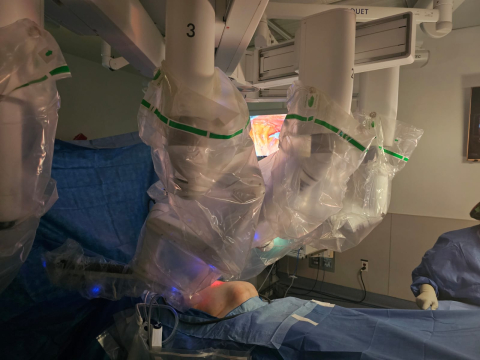 robotic surgical arms during surgery