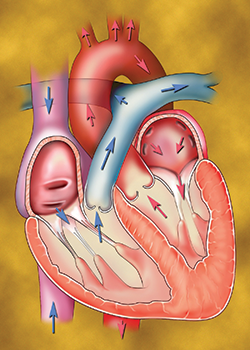 Hypertrophic Cardiomyopathy Center at NYP/Columbia | Columbia Surgery