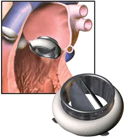 Rendering of Mechanical Valve