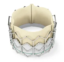 Edwards SAPIEN transcatheter heart valve