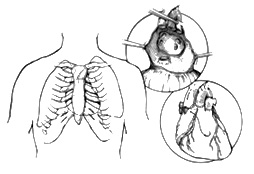 Post-Operative Instructions for Cardiothoracic Surgery