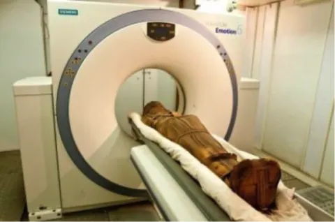 Mummy of Esankh, male, Third Intermediate Period (1070-712 BCE), undergoing CT scanning.