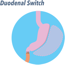 OMAD Keto: Your 7-Day Guide to One Meal A Day on Keto