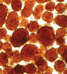 Islet cells