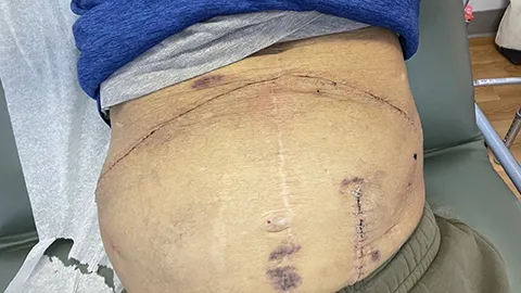 Jerry shares much of his recovery on Twitter: