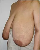 Pre-op