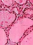 Fig 1. Normal thyroid tissue