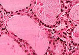 Fig 1. Normal thyroid tissue