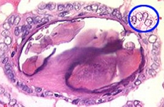 A01831125]Thyroid Cancer Explore vol.3 no.2(2201 「Thyroid