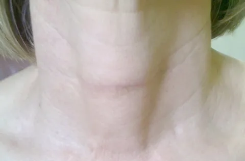 3 week visit