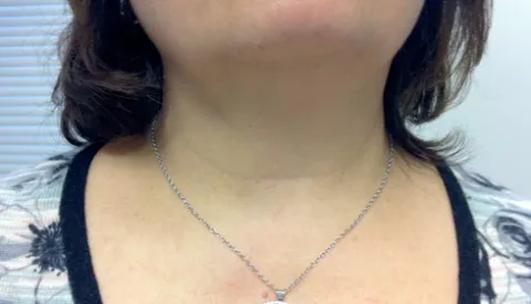 3 week visit