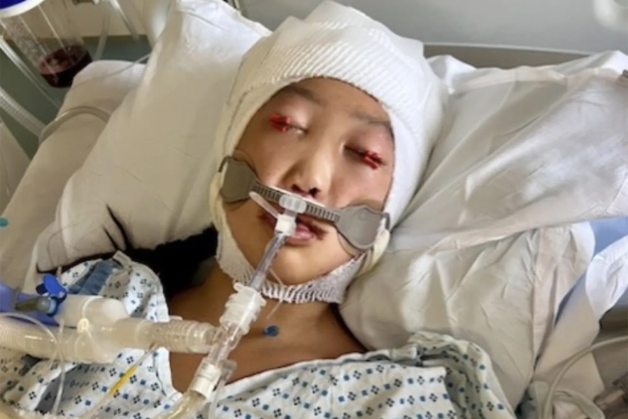 Jade in recovery in the hospital