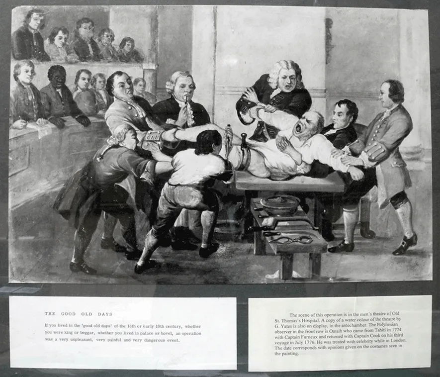 An illustration titled "The Good Old Days," depicts a brutal operating room scene from the late 18th century or early 19th century.