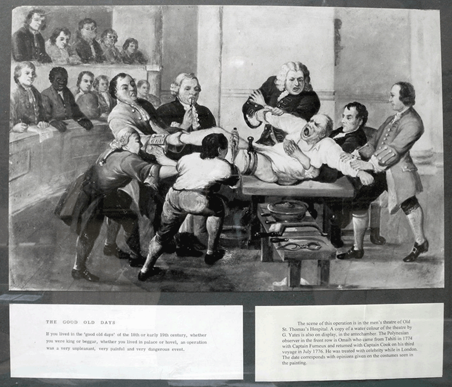 An illustration titled "The Good Old Days," depicts a brutal operating room scene from the late 18th century or early 19th century.
