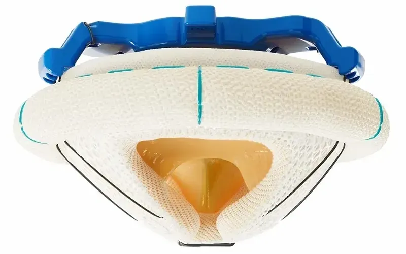 a prosthetic valve