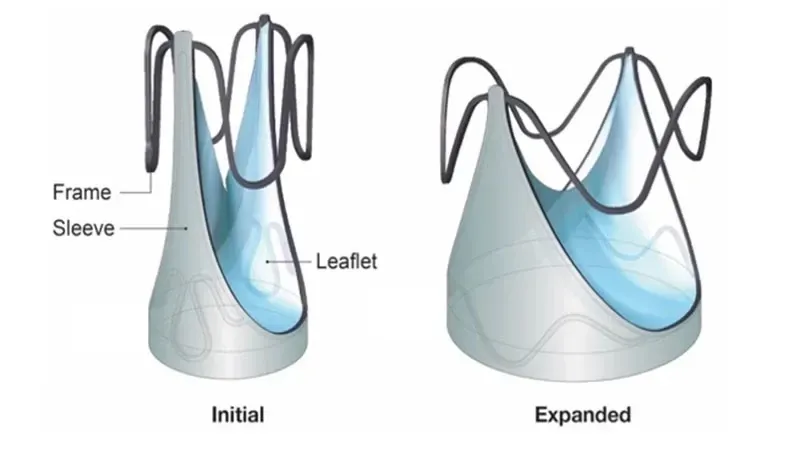 illustration of two valves