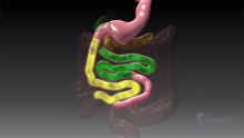 Video Thumbnail: Duodenal Switch