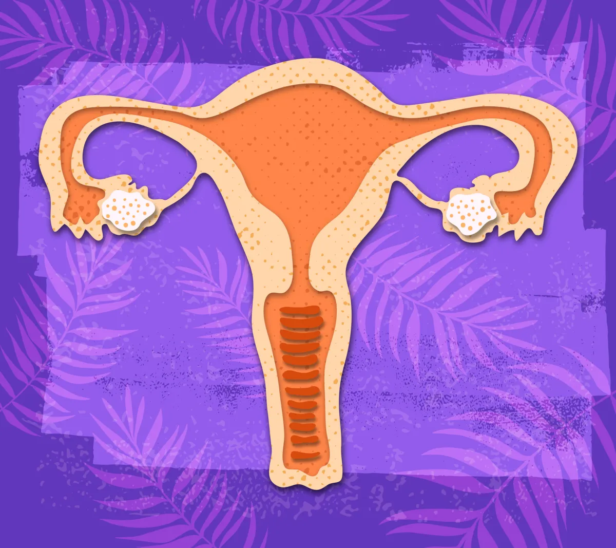 Female Contraceptives Concept In Cut Paper Style