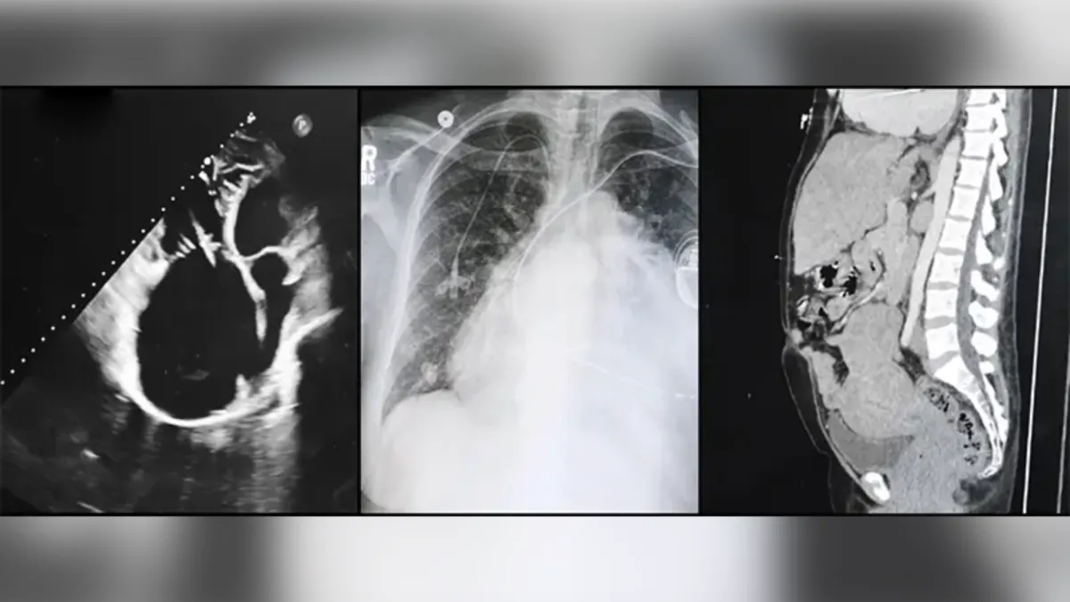 From left, imaging of Nadine's heart, lung, and liver.