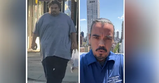 side by side of David before and after surgery