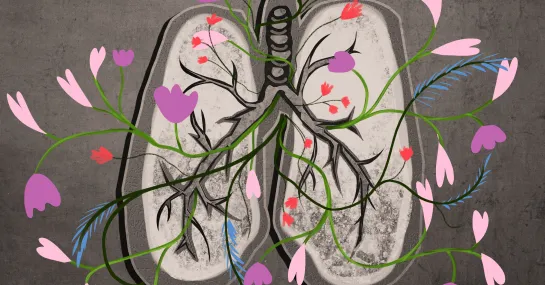 Concept of Lung Cancer illustration
