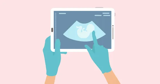 Digital 2D illustration of imaging of a fetus shown on a handheld device with surgeon's gloved hands holding the device and pointing to the fetus.