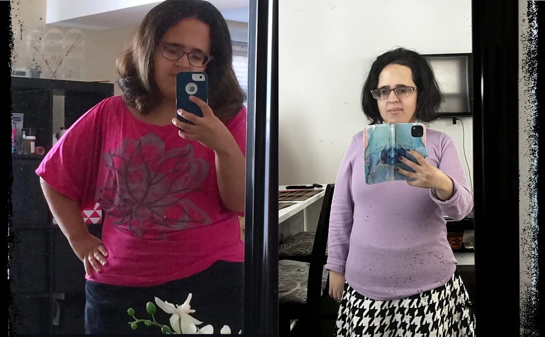 side by side photos of a patient before and after weight loss surgery