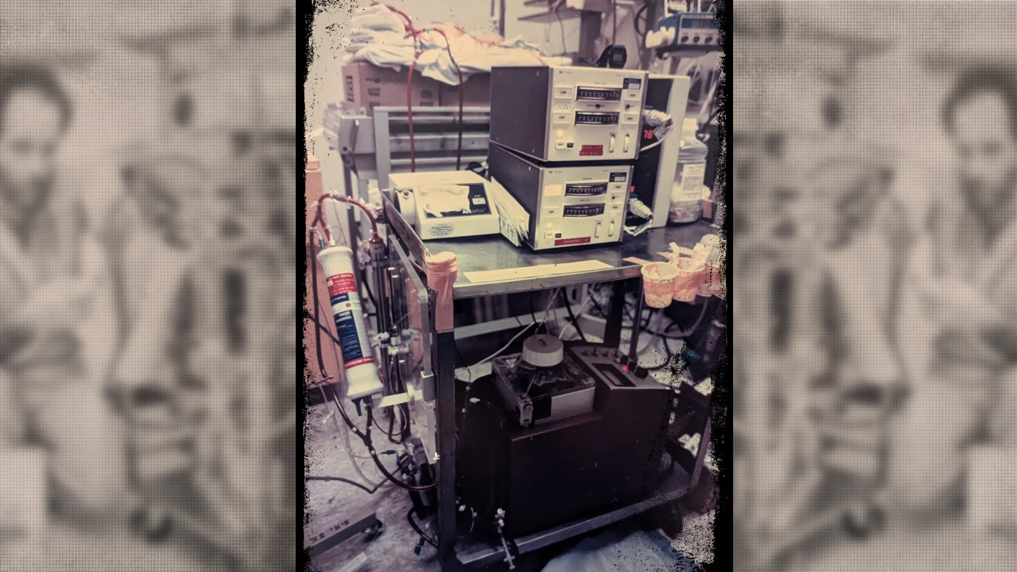 A triptych of blurred photos of Dr. Stolar flanking an image of the first ECMO cart used