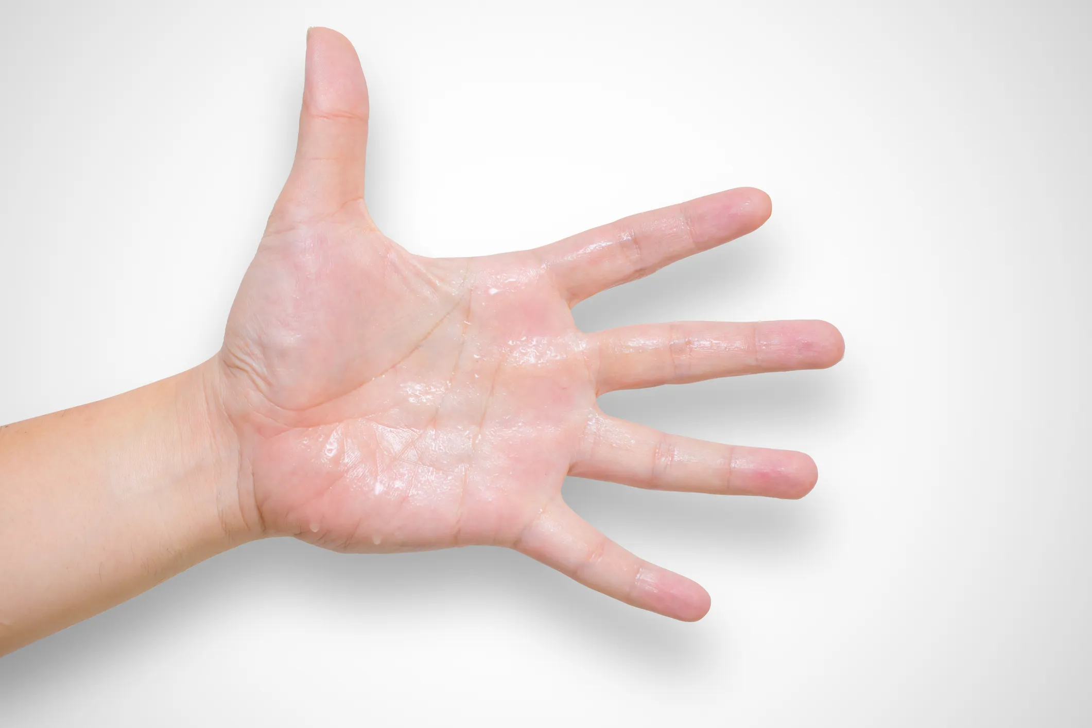 close up of a hand with sweat