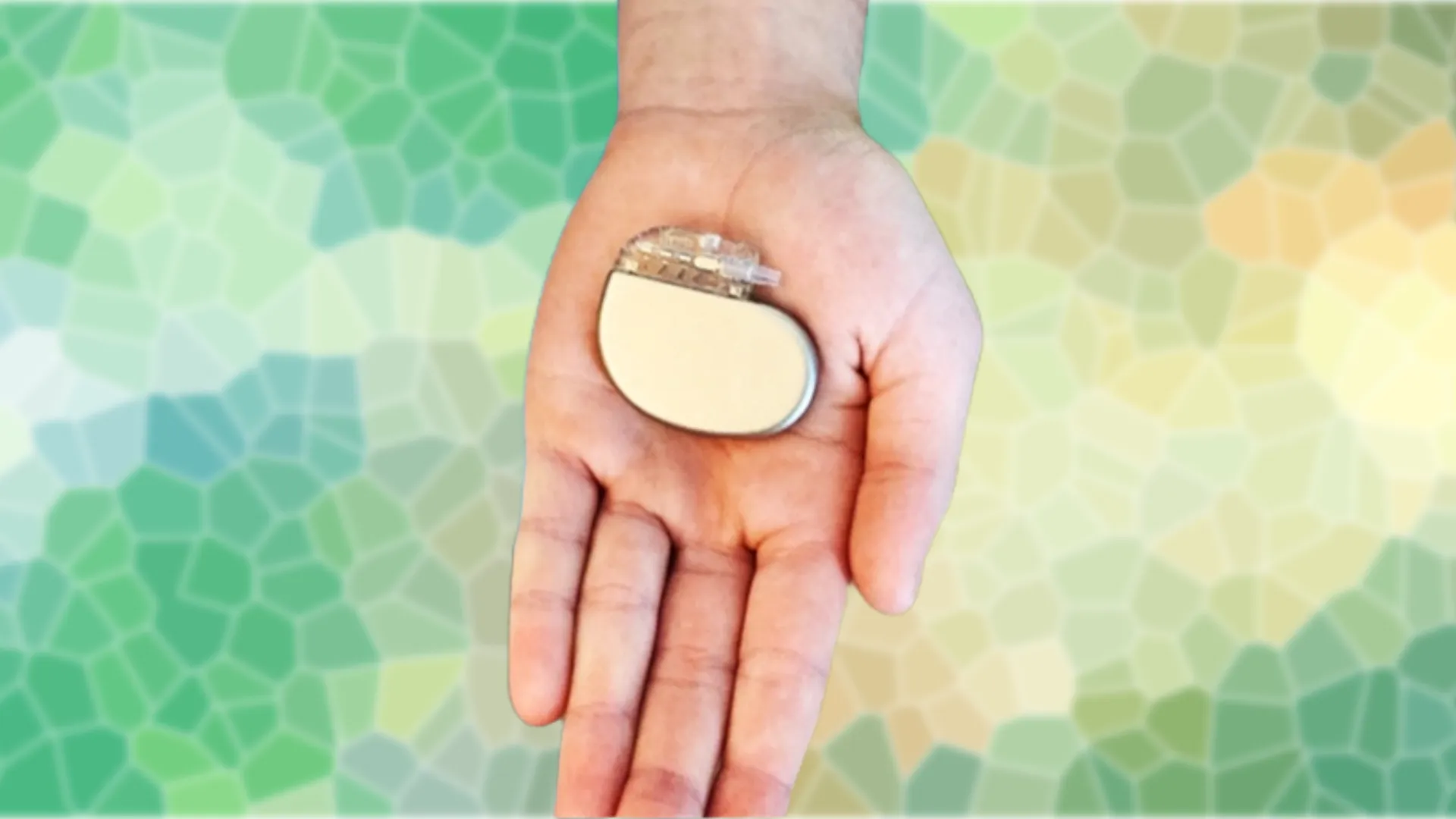 a hand holding SNS device over patterned background