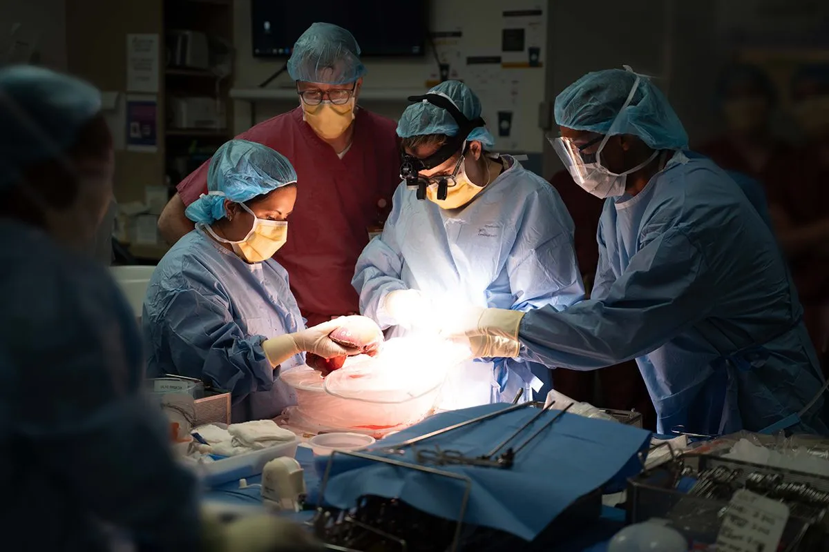 surgeons lift a liver during transplant