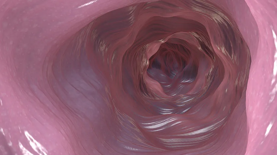 Banner: What Is Interventional IBD ?