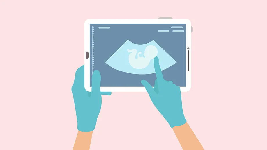 Digital 2D illustration of imaging of a fetus shown on a handheld device with surgeon's gloved hands holding the device and pointing to the fetus.