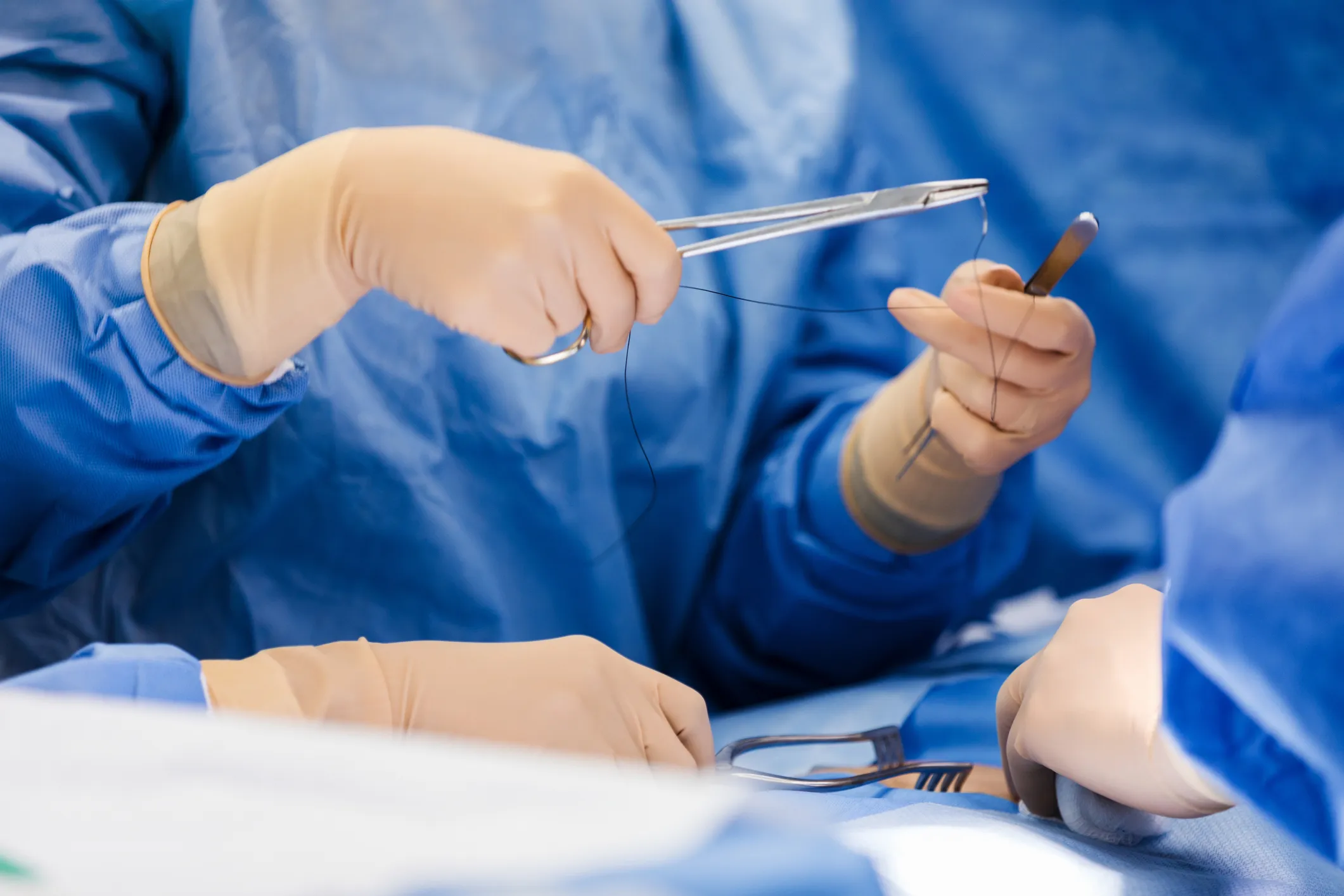 A close up photo of an unrecognizable doctor as she prepares to stitch up the incision.