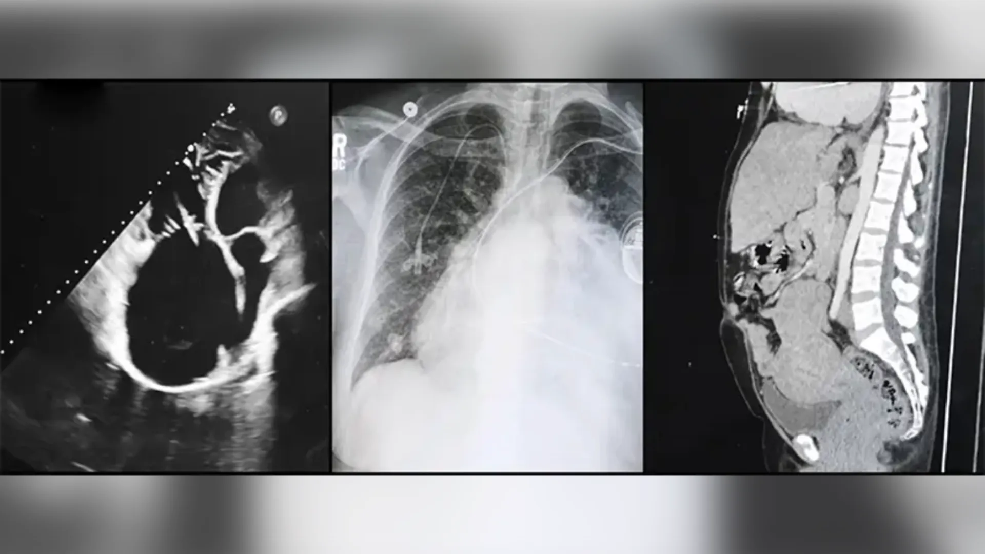 From left, imaging of Nadine's heart, lung, and liver.