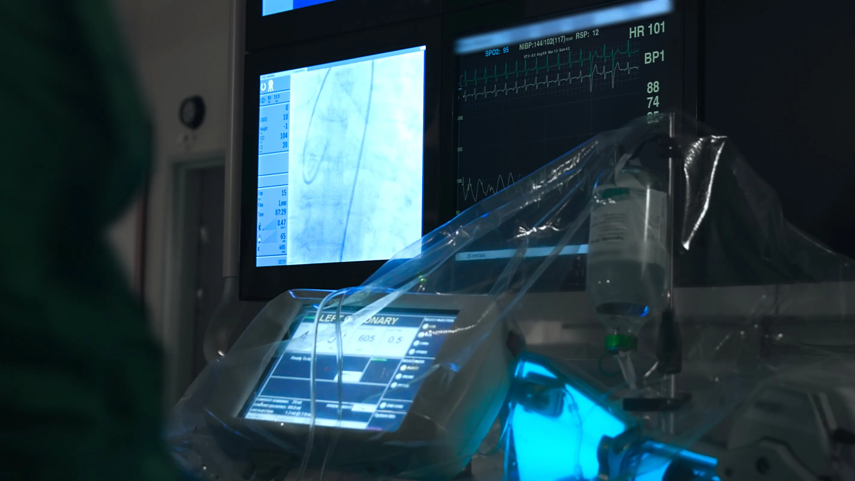 medical equipment in operating room during vascular surgery