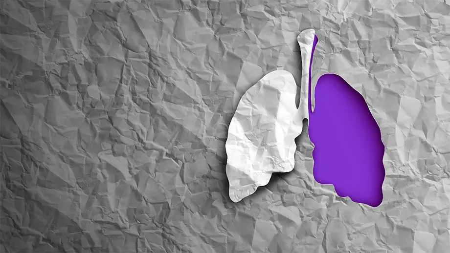 Banner: New Lung Cancer Screening Guidelines Will Save Lives, But There’s Still Work To Do