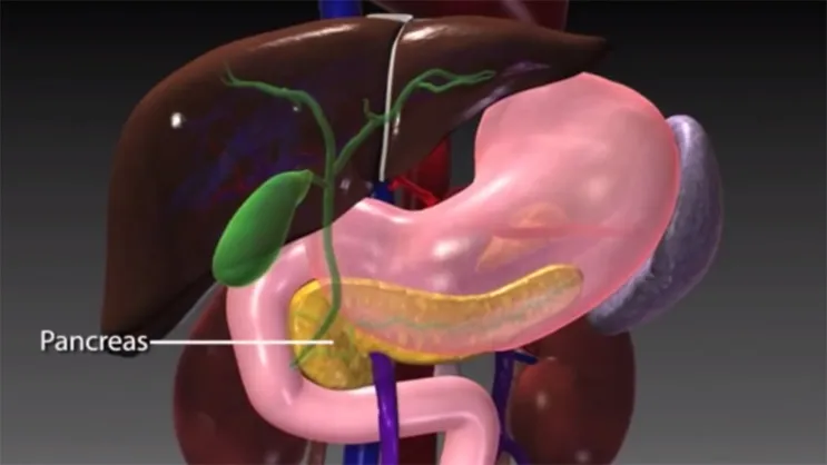 Video Thumbnail: The Whipple Procedure 
