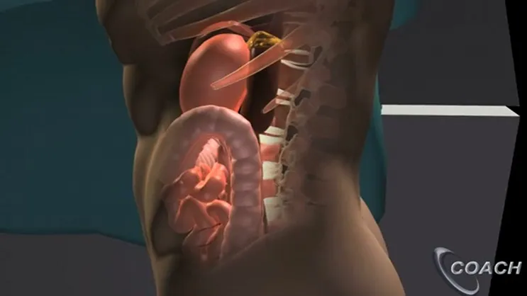 Video Thumbnail: A New Approach to Surgery of the Adrenal Gland: Laparoscopic Retroperitoneal Adrenalectomy