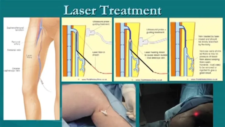 Video Thumbnail: Vein Circulation Problems, Diagnosis, & Management